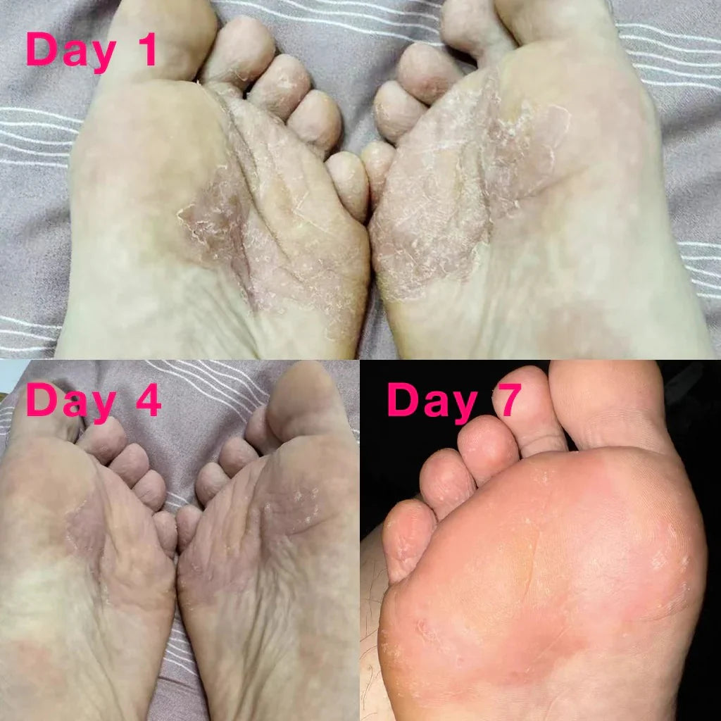 ClariDerm 2X1 Spray Antihongos para Pies y Manos