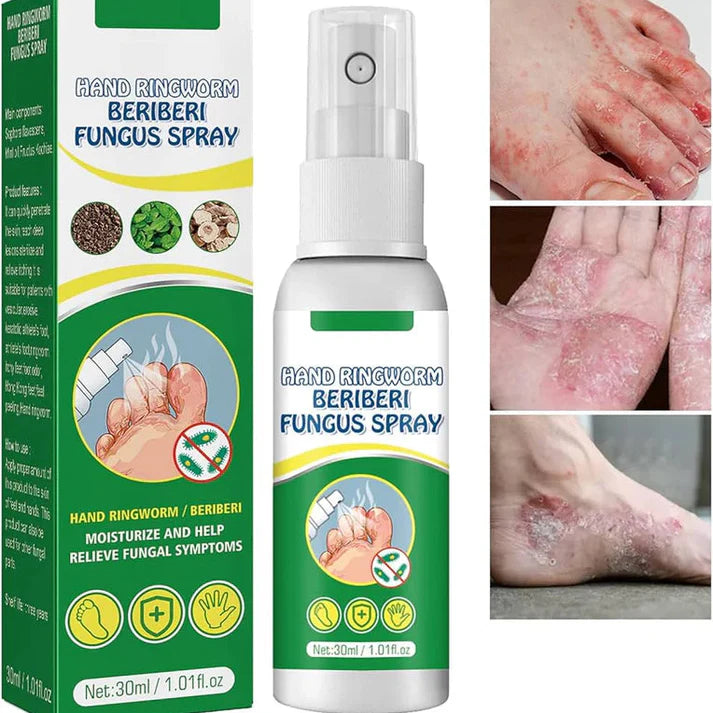 ClariDerm 2X1  Spray Antihongos para Pies y Manos